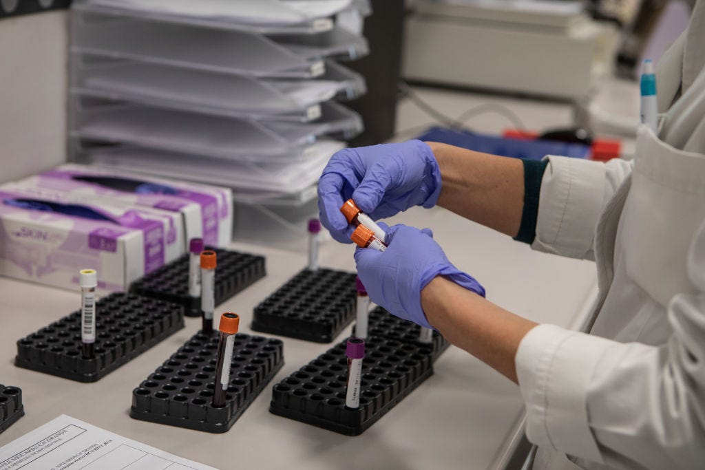 A photo of a nurse holding blood sample vials in a lab. She is wearing purple gloves.
