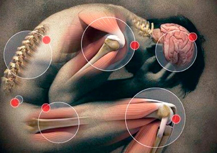 bol u zglobovima i oticanje mozga