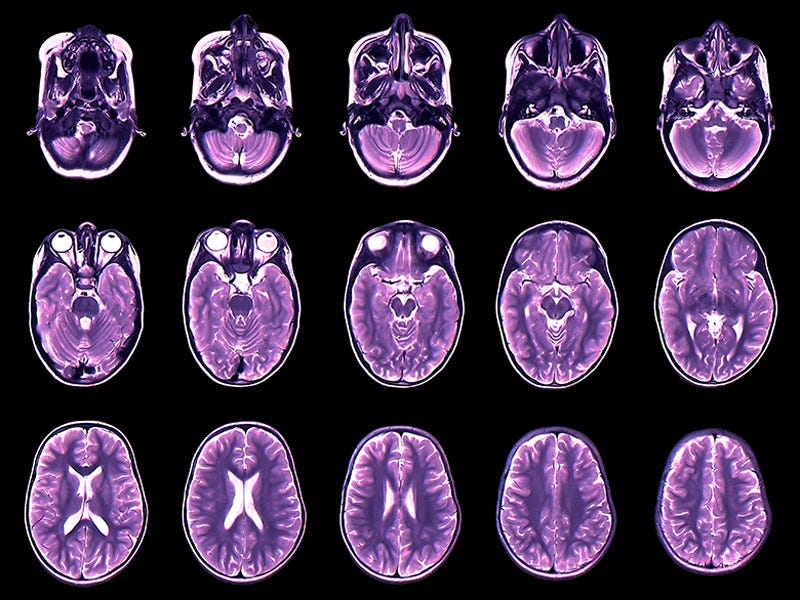 (Foto: Facultad de Psiquiatría de la Universidad de Cambridge)