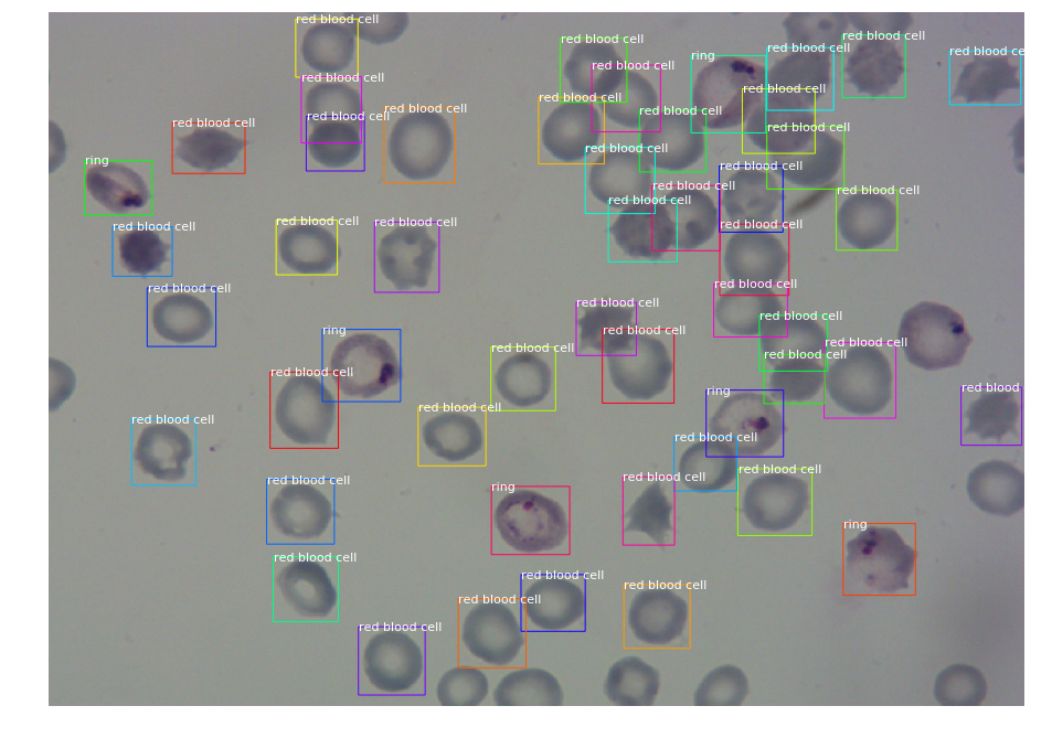 Computer Vision Techniques: Implementing Mask-R CNN on ...