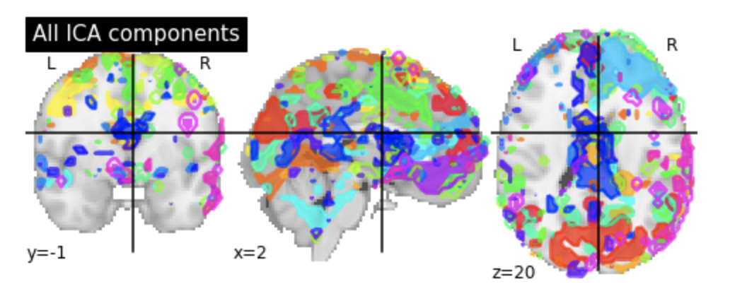 Identifying Resting State Networks From Fmri Data Using Icas By Gili Karni Towards Data Science Identifying Resting State Networks From Fmri Data Using Icas By Gili Karni Towards Data Science