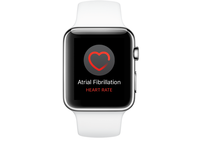 iwatch heart ekg