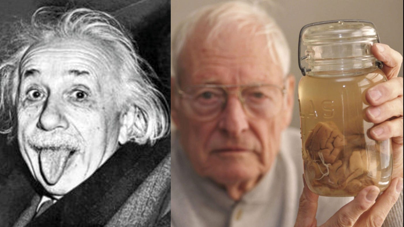 The Incredibly Weird Story Of Einstein S Brain By Jayden Yugie History Of Yesterday