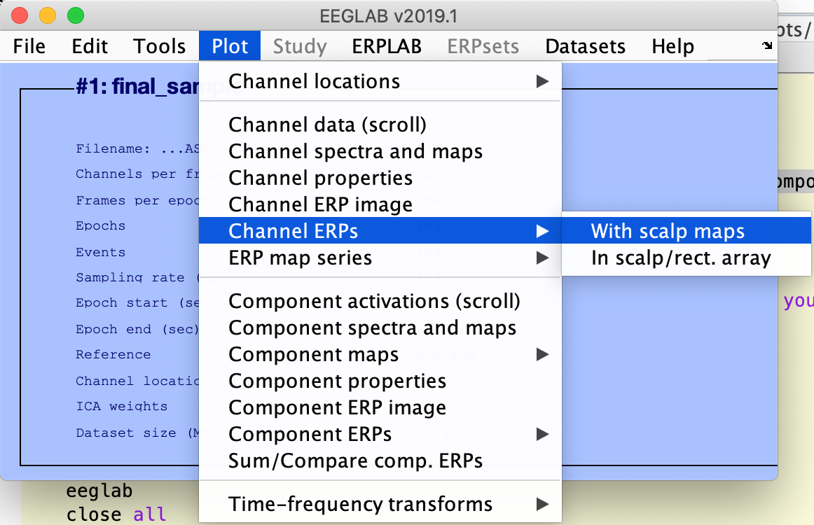 Streamline your EEGLAB experience | by Danielle Gruber | DataDrivenInvestor