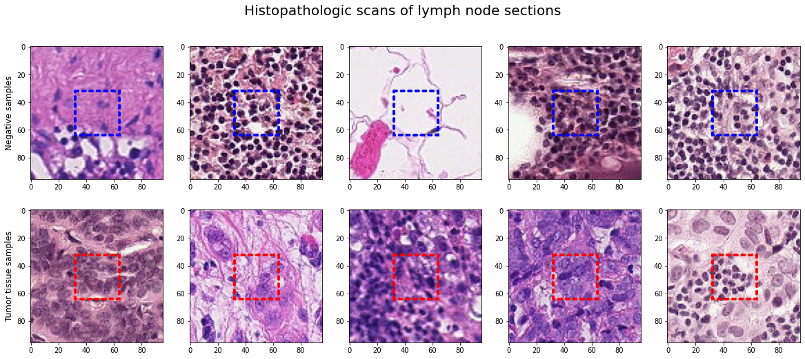 Histopathologic Cancer Detection. Elvin Mirzazada, Master of Computer ...