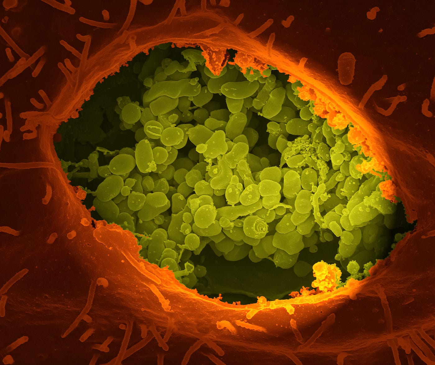 Coxiella burnetii — bacteria causing Q fever; image by the CDC; it is the shape of a flaming red eye with the center filled in by yellow pellets.