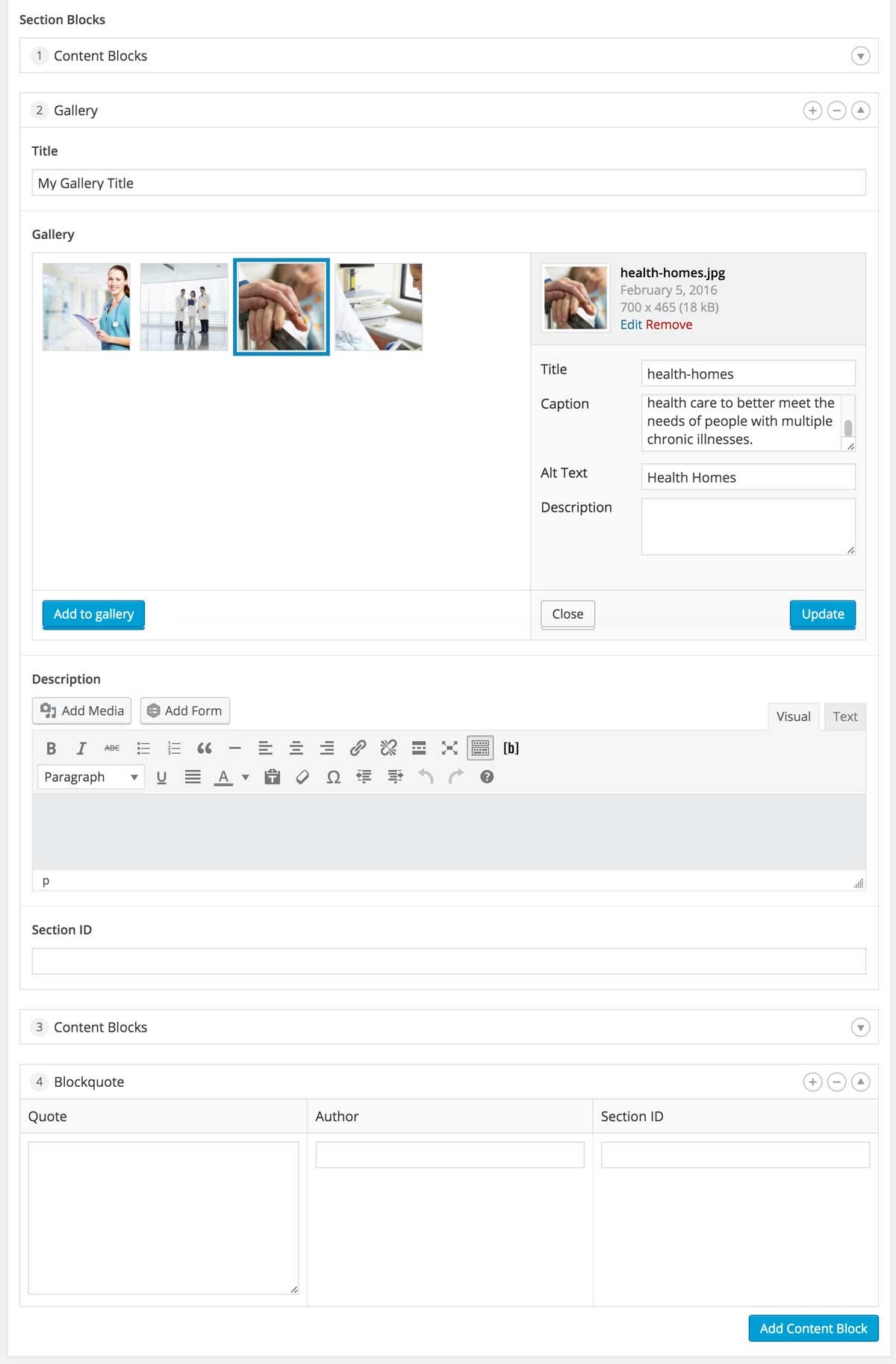 Modular Web Design Meets WordPress with Advanced Custom Fields | by ...