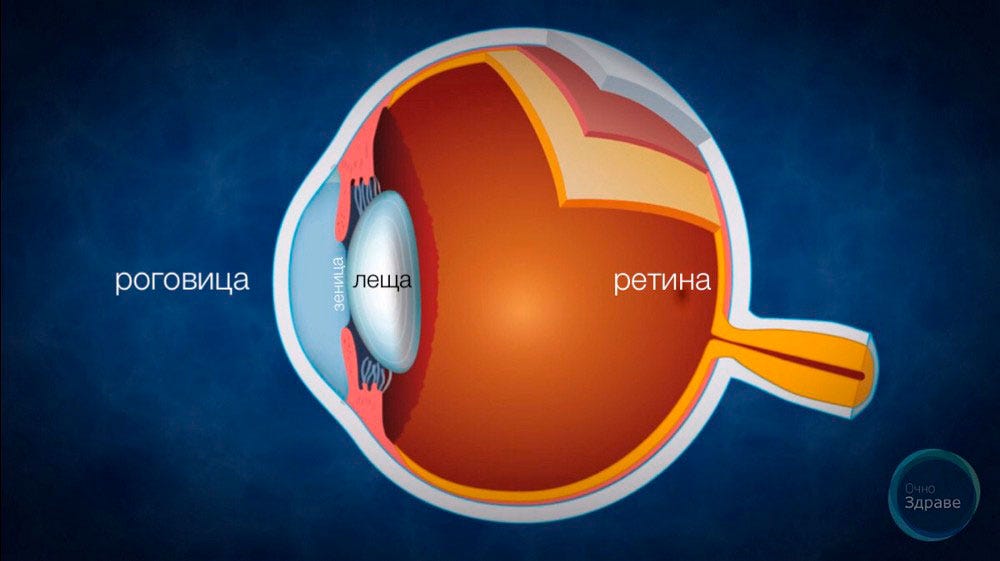 Лазерна корекция на зрението. Премахнете очилата и контактните лещи | by  Atanas Bogoev M.D. | Очно Здраве