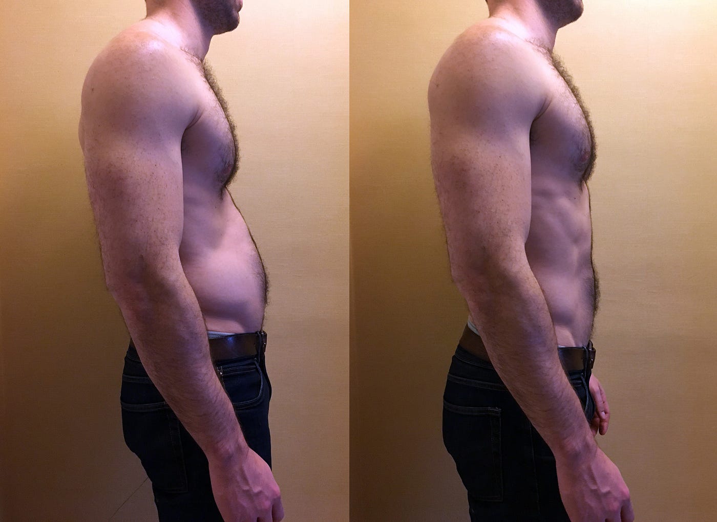 Lordosis on the left, normal curvature on the right. 