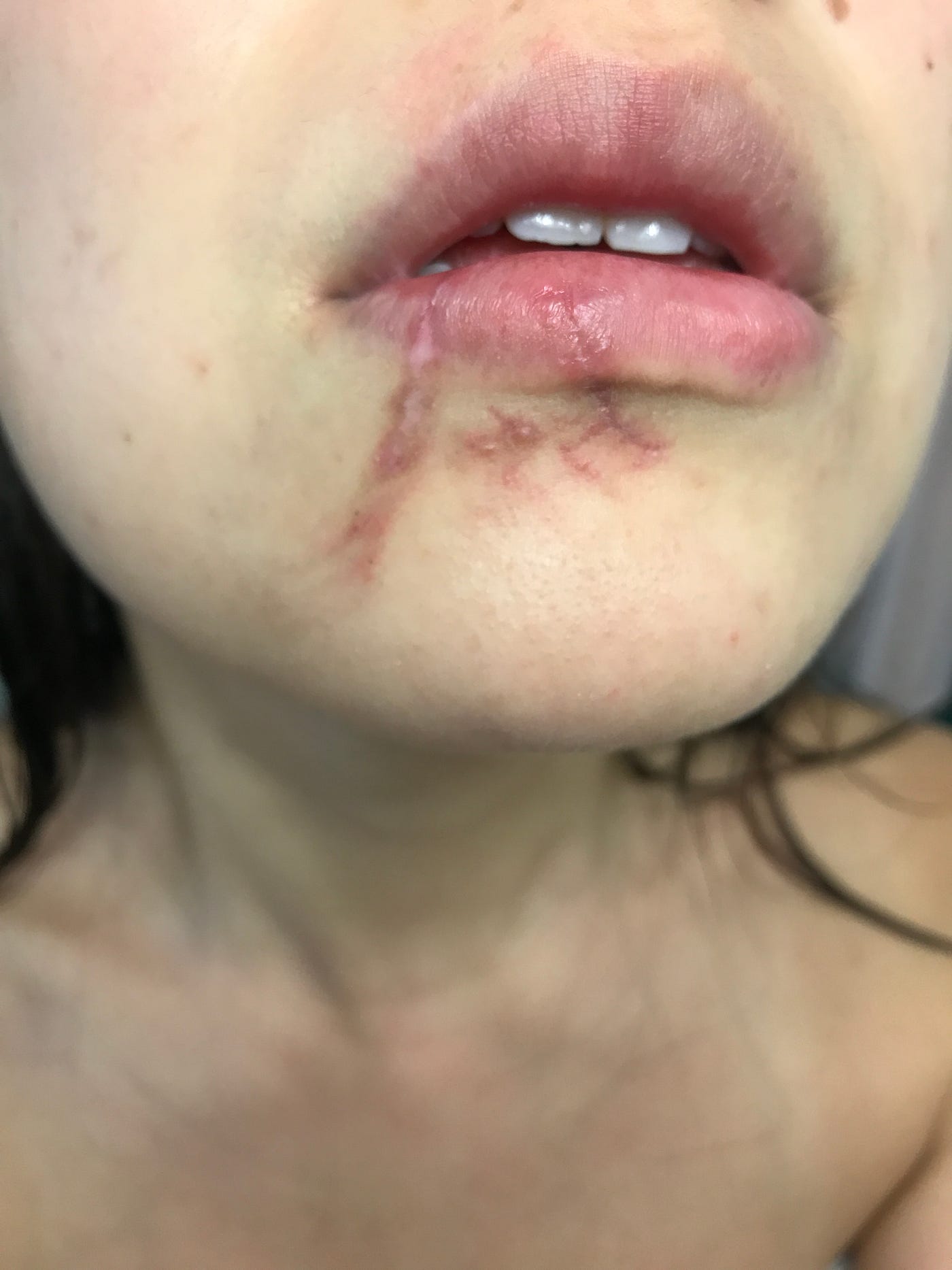 why does my dog bite my face