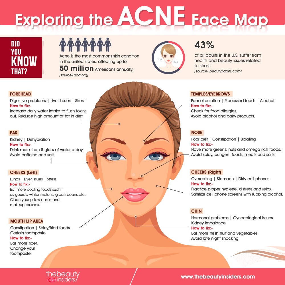 Acne Face Map: Know what does acne reveal about your health | by Mia ...