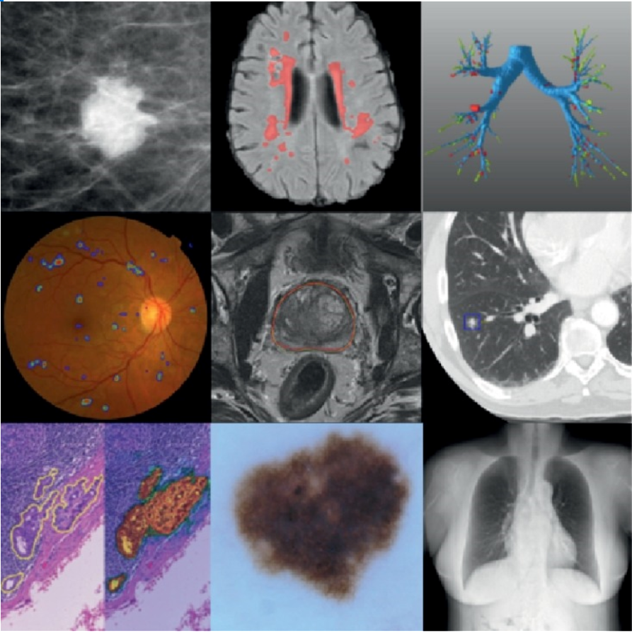 Deep Learning Applications In Medical Image Analysis