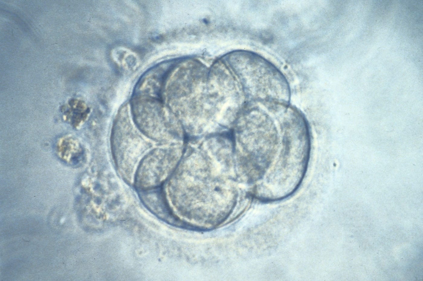 Human eight cell embryo for IVF selection.