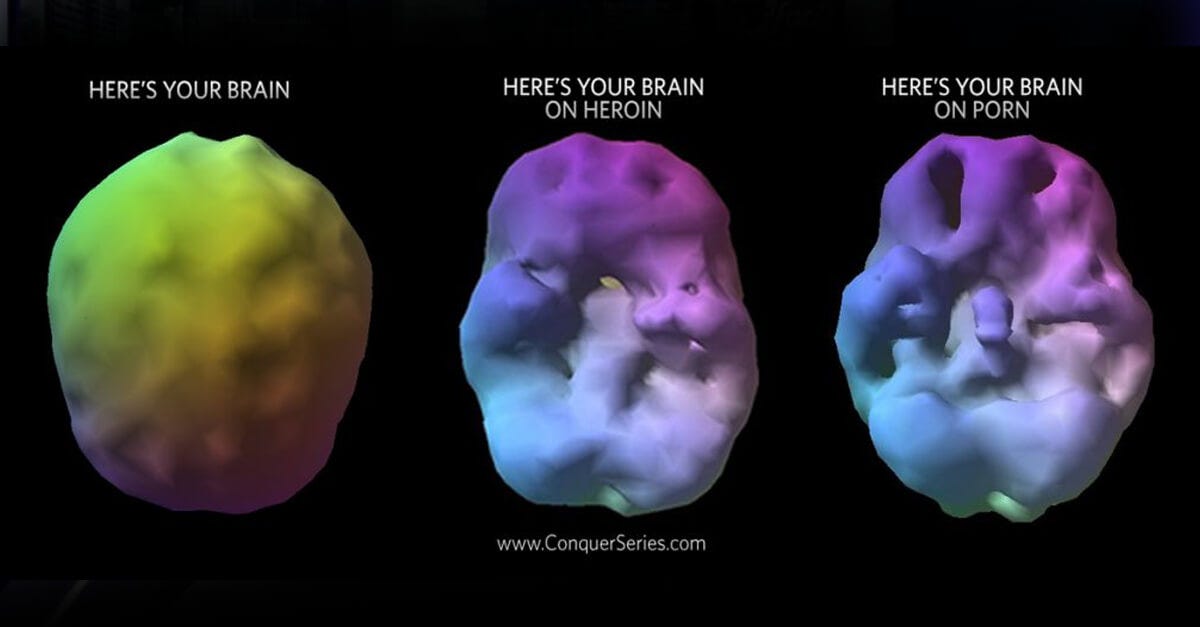 What Porn Does To Your Brain And How To Quit By Mohammedraza Esmail What Porn Does To Your Brain And How To Quit By Mohammedraza Esmail