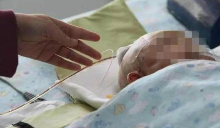 Apple Dropped From 24th Floor Hits 3 Month Old Baby In Head Puts
