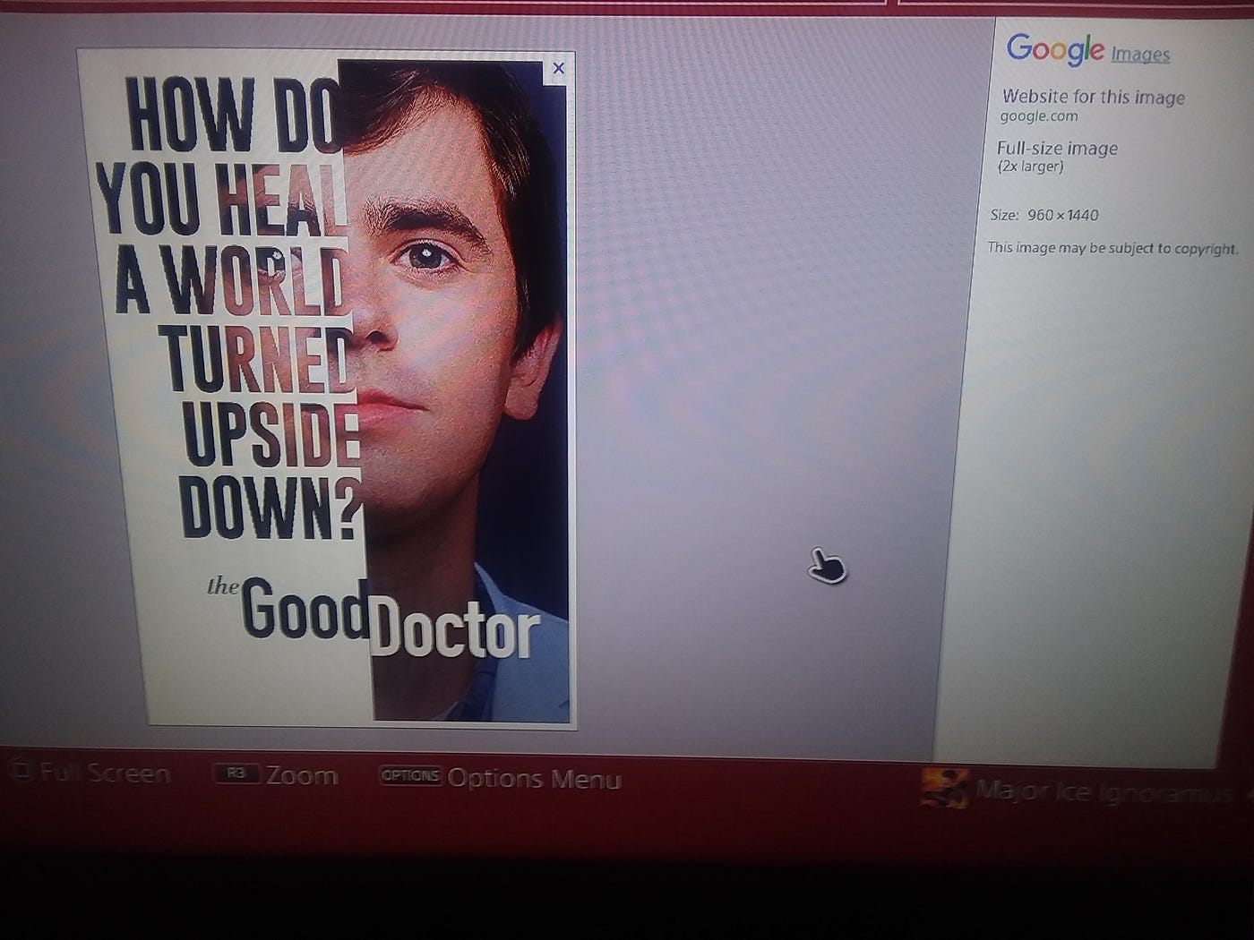 The Savant Part is Easy. The Idiot Part Comes Later. It Means You Put