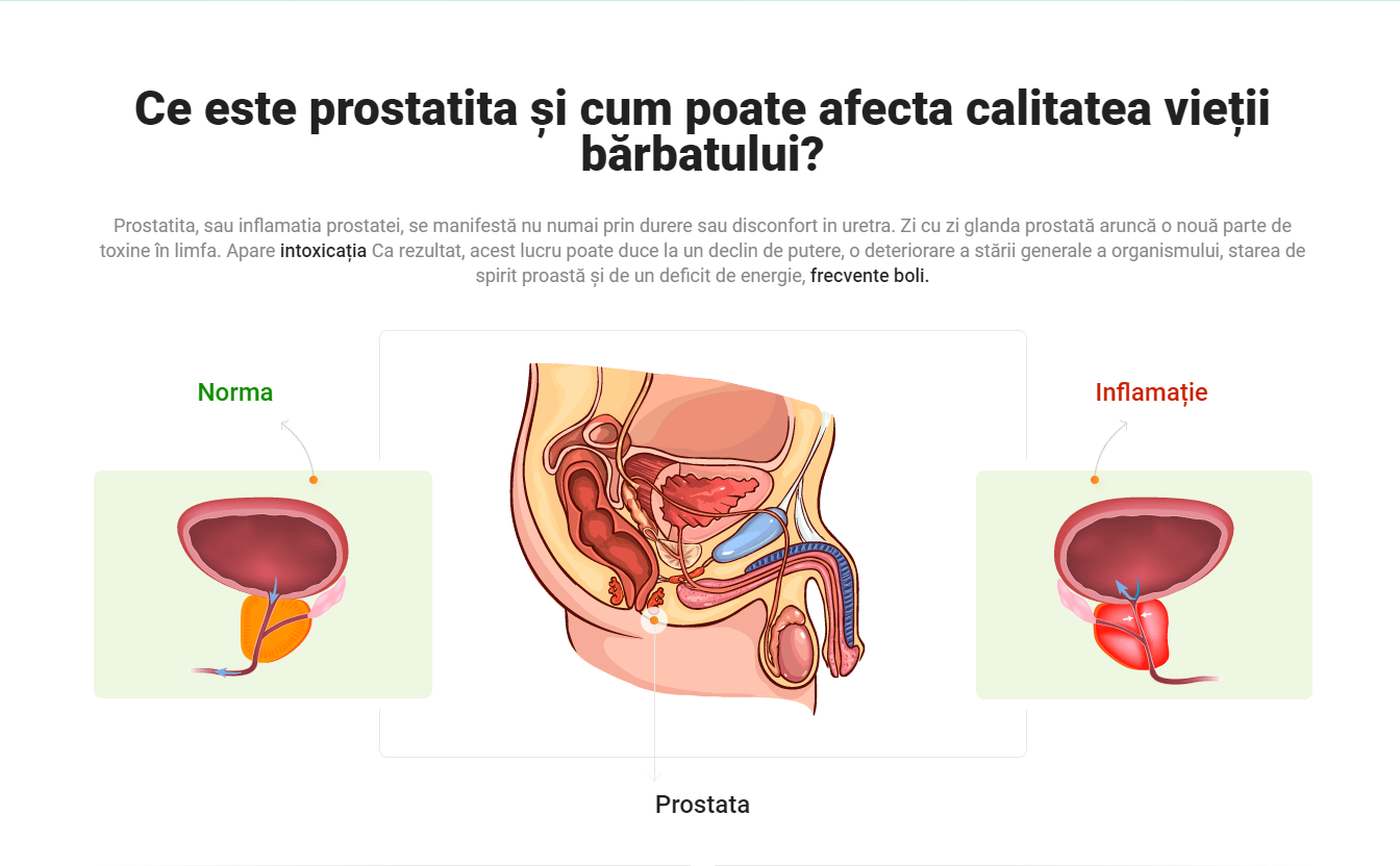 prostatita ameliorează inflamația metode de tratare a prostatitei