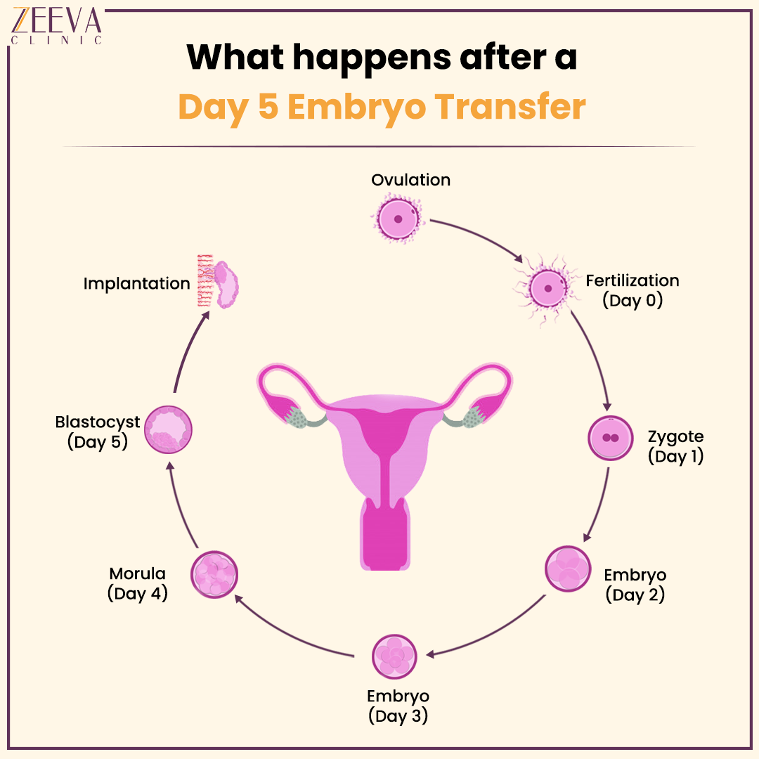 long distance travel after embryo transfer