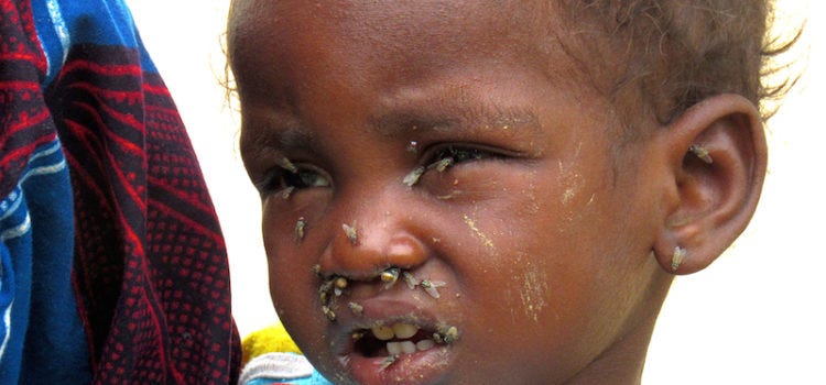 The Dirty Reason Why Starving Children Are The Face Of Africa In The