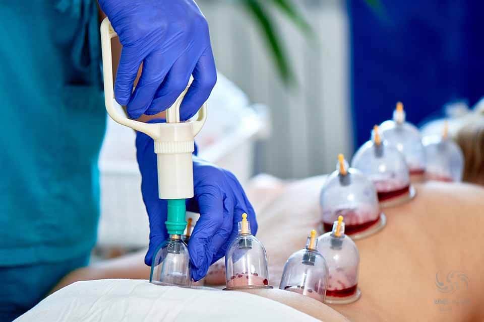 انجام مکرر حجامت باعث ایجاد کم خونی در فرد می شود.