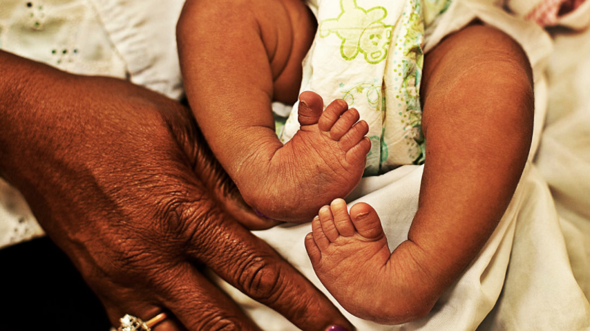 Clubfeet And How You Can Help I Have A Clubfoot And So Do A Whole By Istandbeautiful Medium