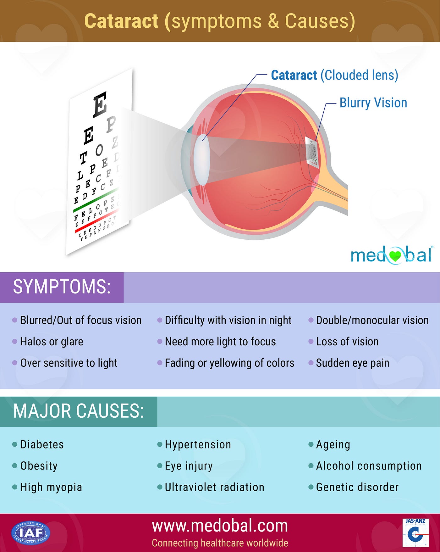 Cataract Symptoms and Causes