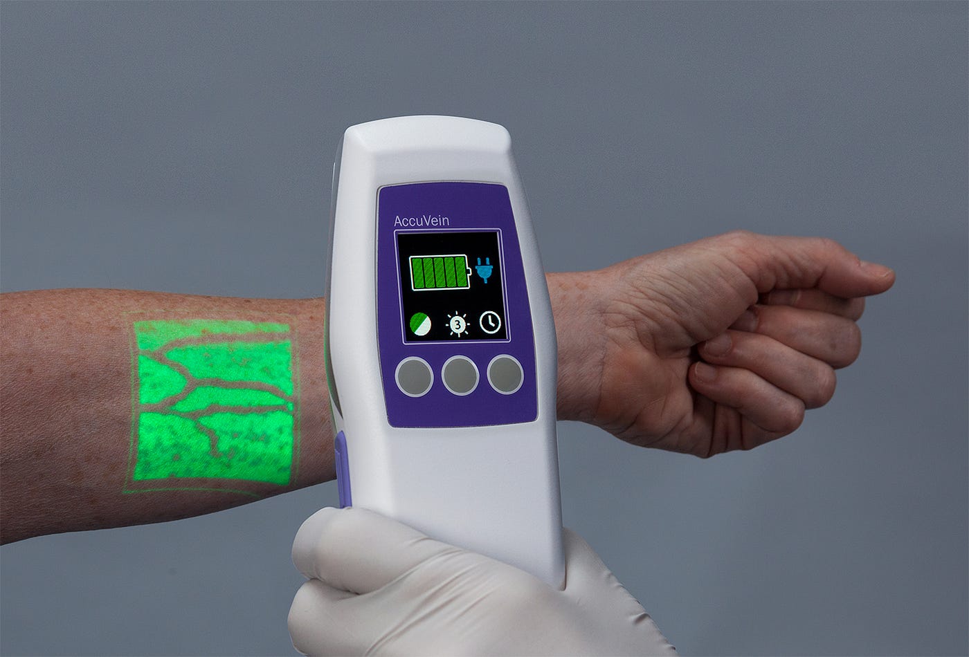 Photo of Accuvein device. XR technology like Accuvein can help nurses find veins easily on the patient. Approximately 40% of IV injections miss their target on the first stick.
