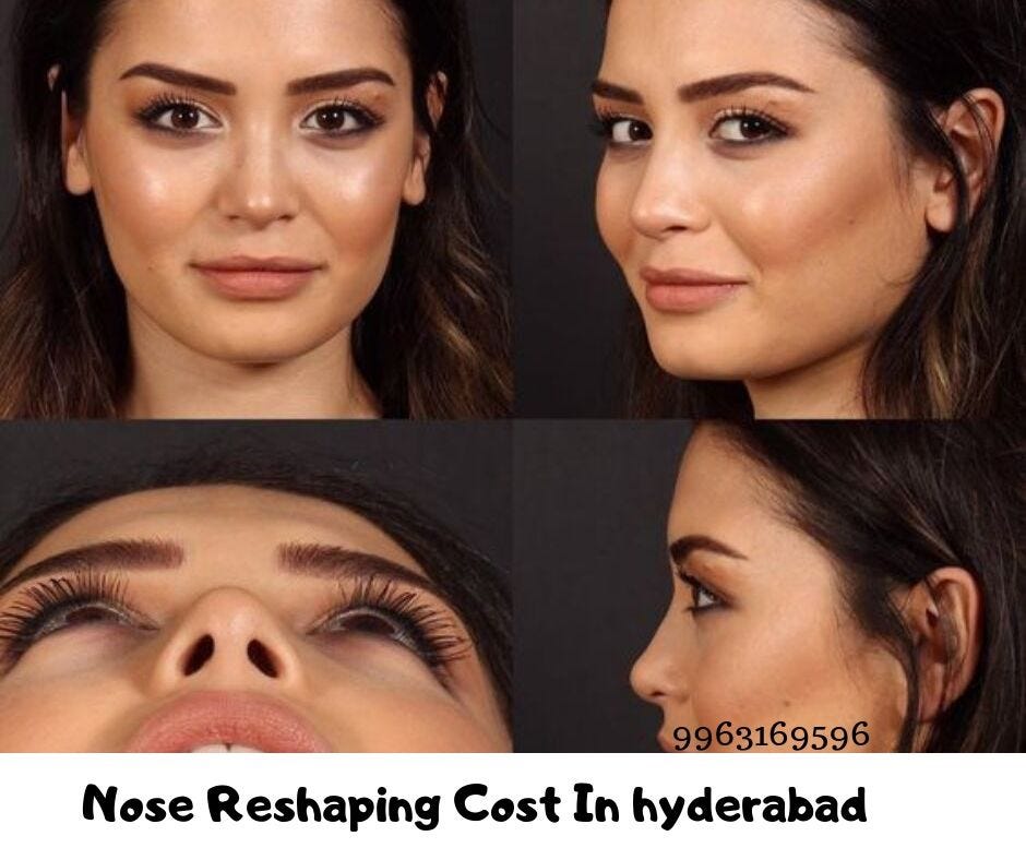 Is Nose Surgery For You Nose Surgery Cost In Hyderabad By Naresh Medium