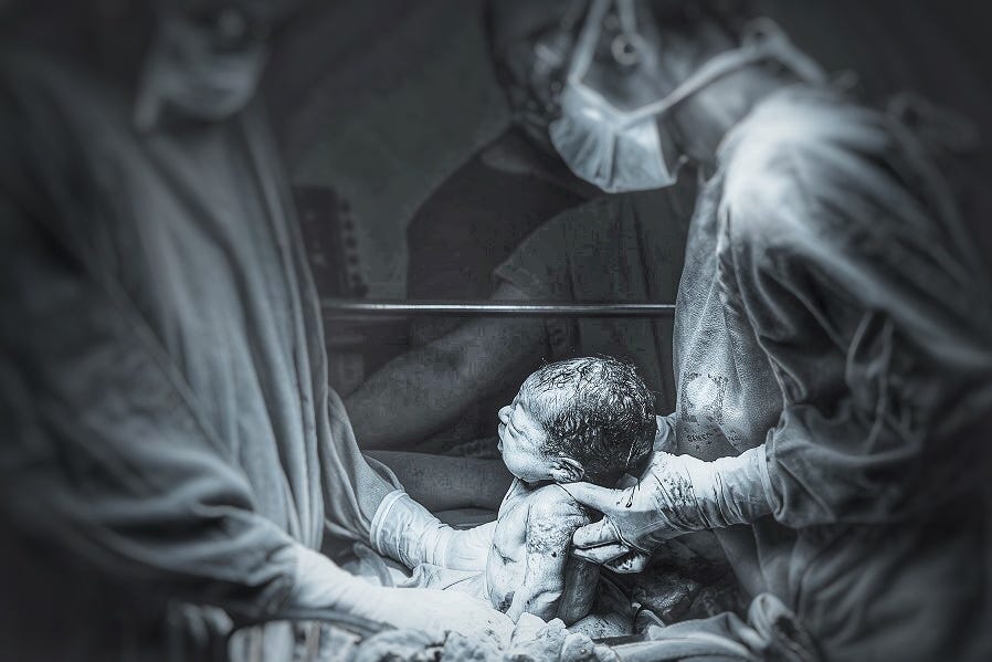 black and white photo of a baby being delivered in a hospital with a doctor and nurse present