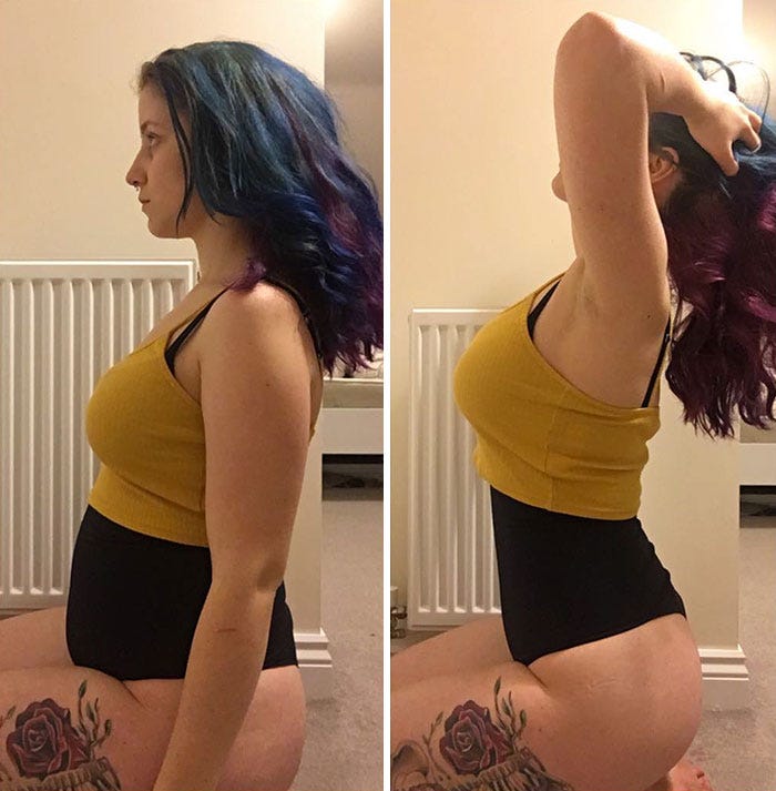 Mujeres antes y despues de adelgazar y
