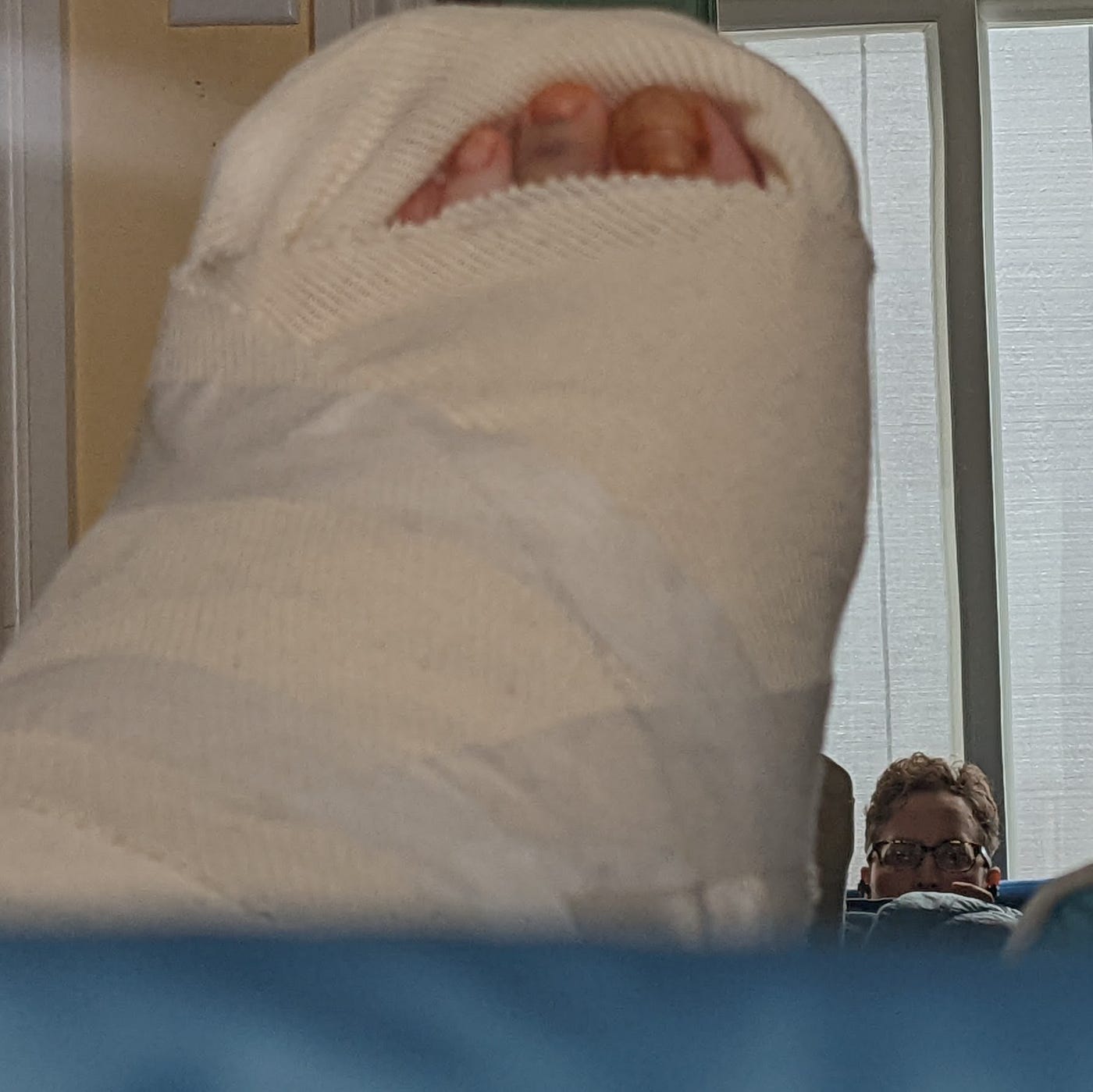 Leg, in a splint, elevated on pillow