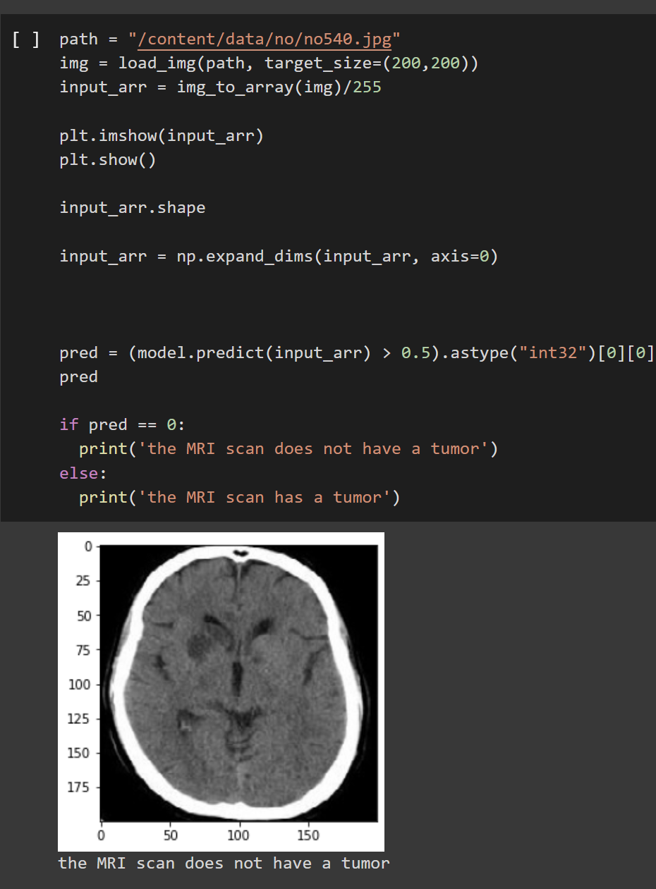 Brain Tumor Detection using Deep Learning | by Odeyemi Ibukun Akinola ...