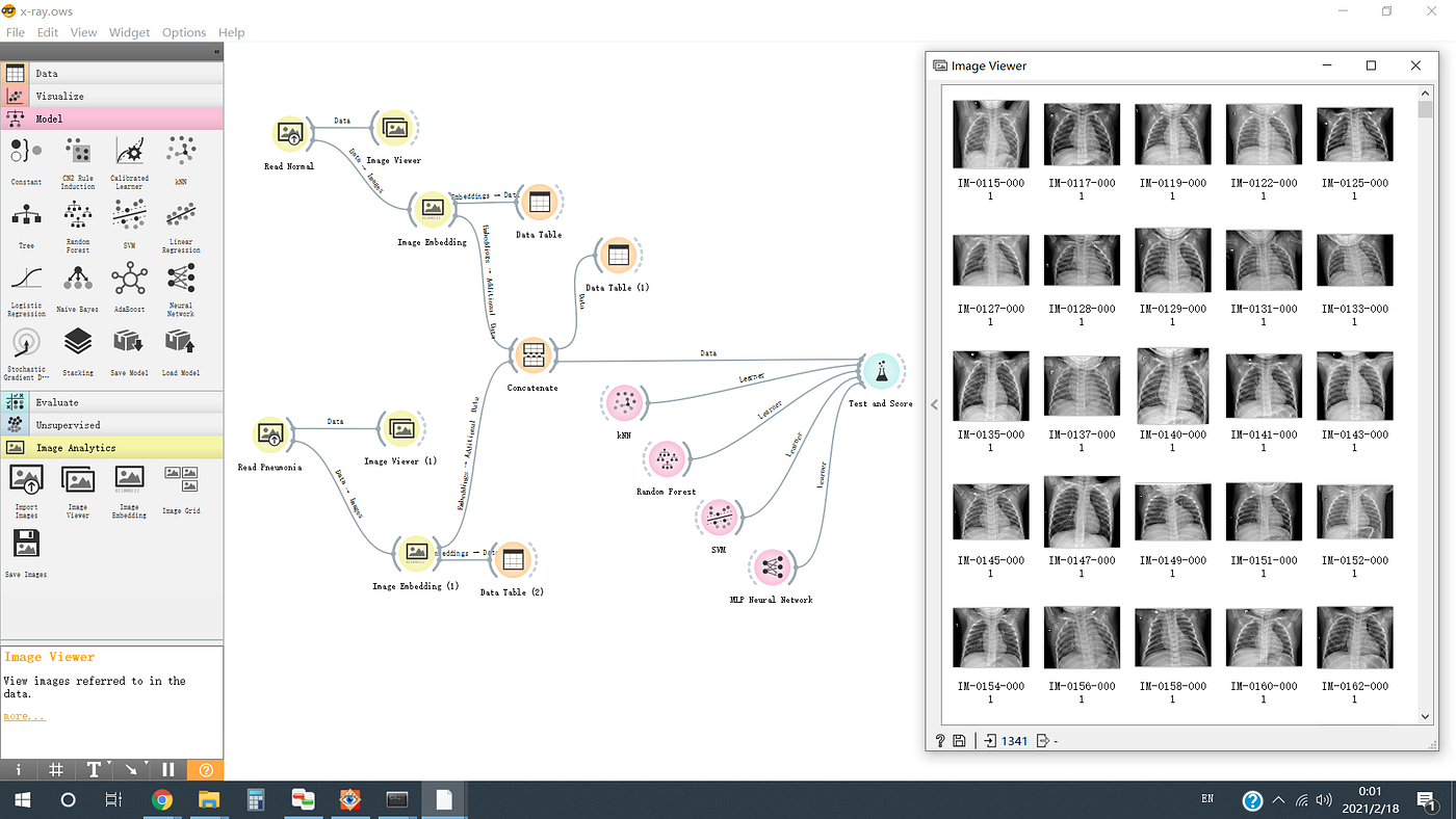Detecting Pneumonia in Chest XRay Images under Orange Machine Learning
