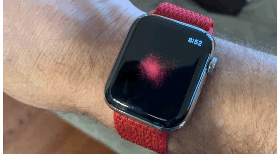 electrocardiogram apple watch