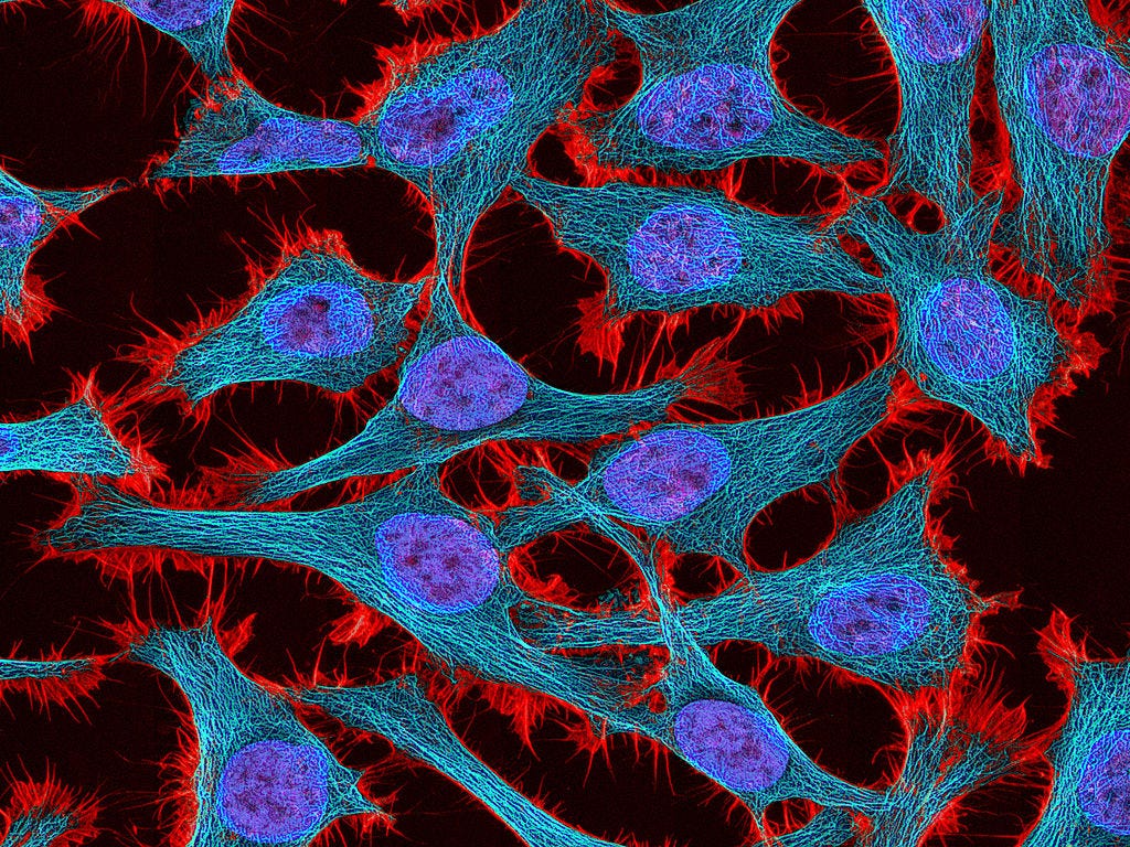 A photo taken through a microscope shows HeLa cells cultured from tissue taken from Henrietta Lacks. The cells appear on a black background. They are stained with additives that make them appear cyan blue with a purple center and red fringe on the edges.