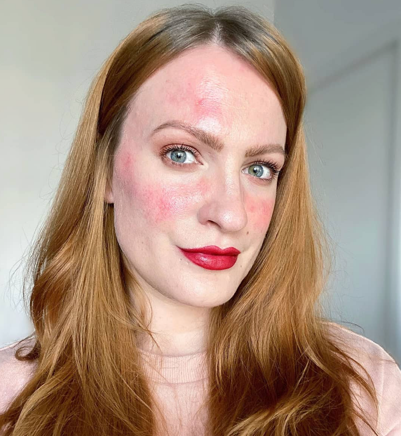 When I stopped seeing my skin as my enemy, it changed my perspective” | by  Feelunique | Medium