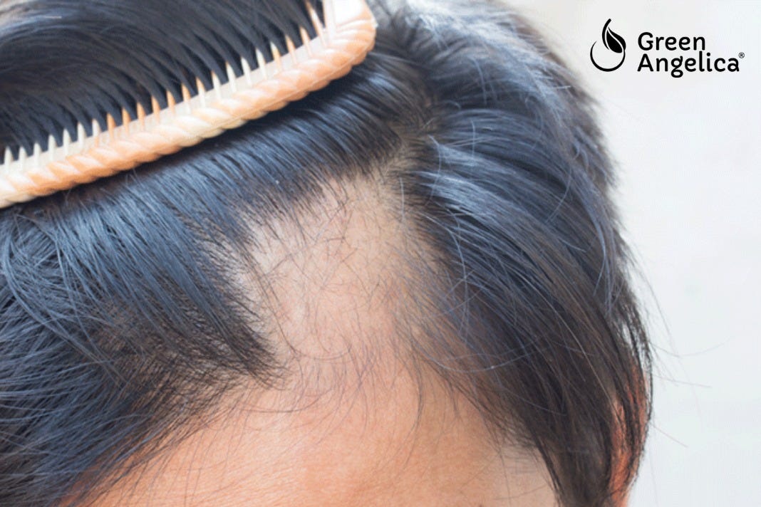 6 Langkah Gampang Menjaga Rambut supaya tidak gampang Rontok serta ...