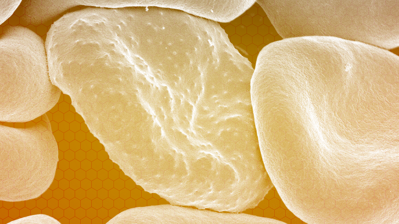 An up-close view of blood cells, with a transparent yellow overlay.