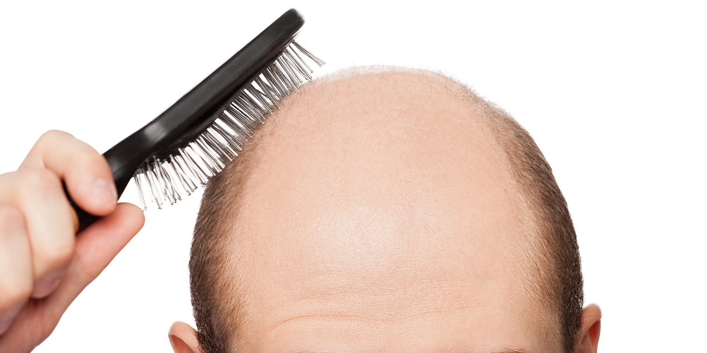 Save your hair. There is nothing unusual about losing… | by MOMO SONG |  Medium