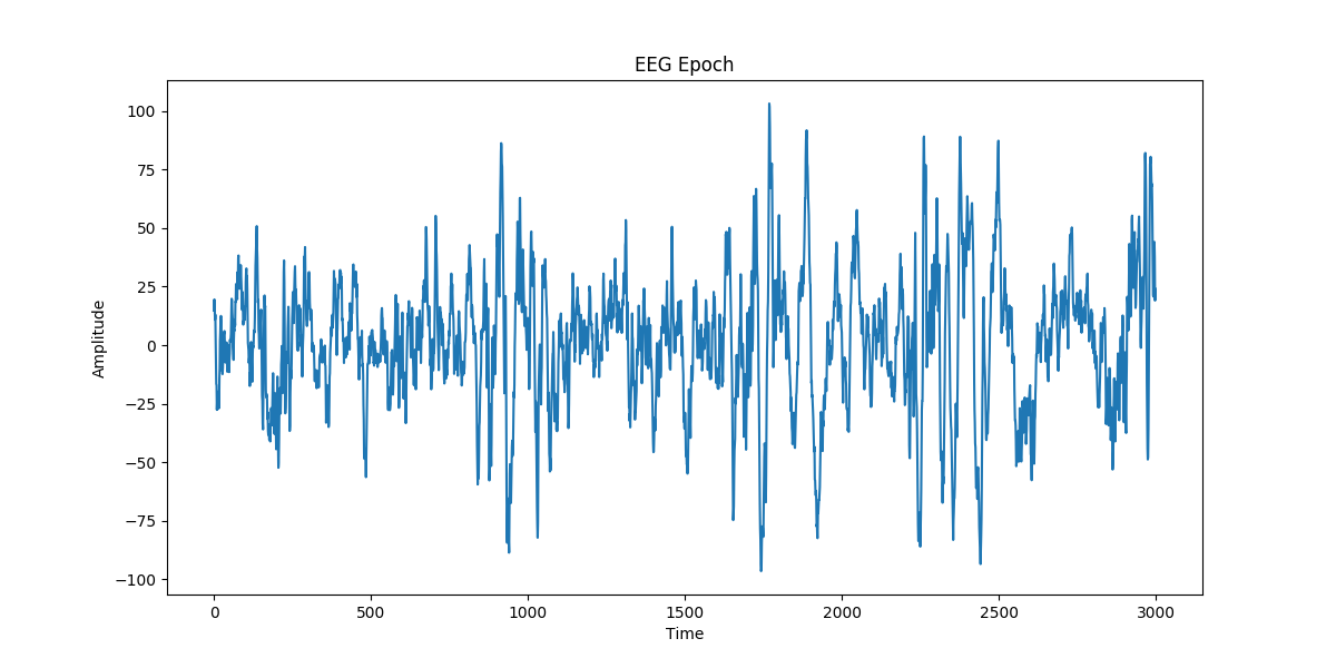 Sleep Stage Classification from Single Channel EEG using Convolutional