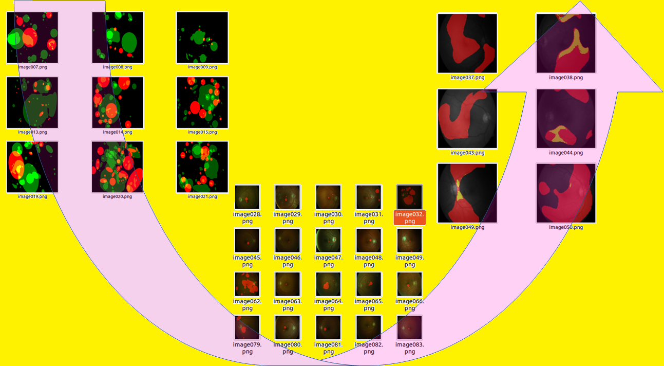 programming assignment image segmentation with u net