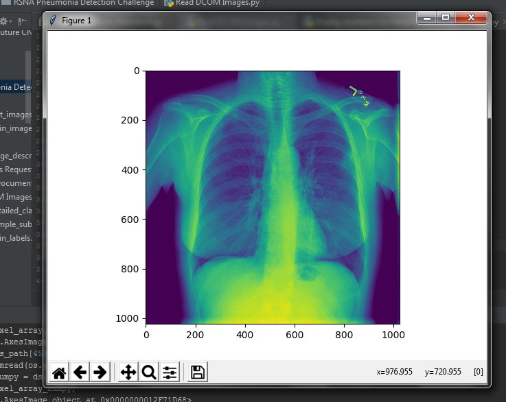 DICOM to JPG and extract all patients information using python. | by ...