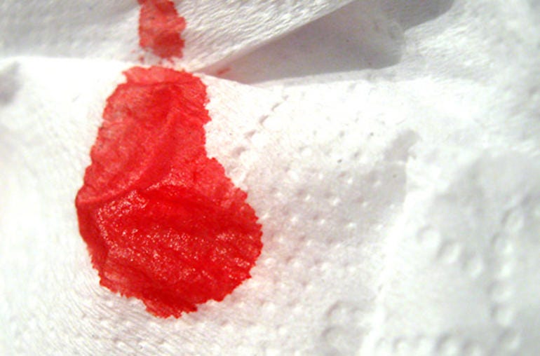 Can the color of the menstrual blood unlock the code to your health ...