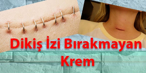 Yara Izi Tedavisi Prof Dr Cengiz Acikel