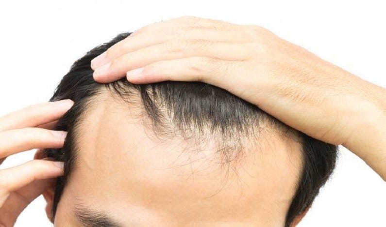 Finding Out The Problems For Hair Loss For A Better Hair