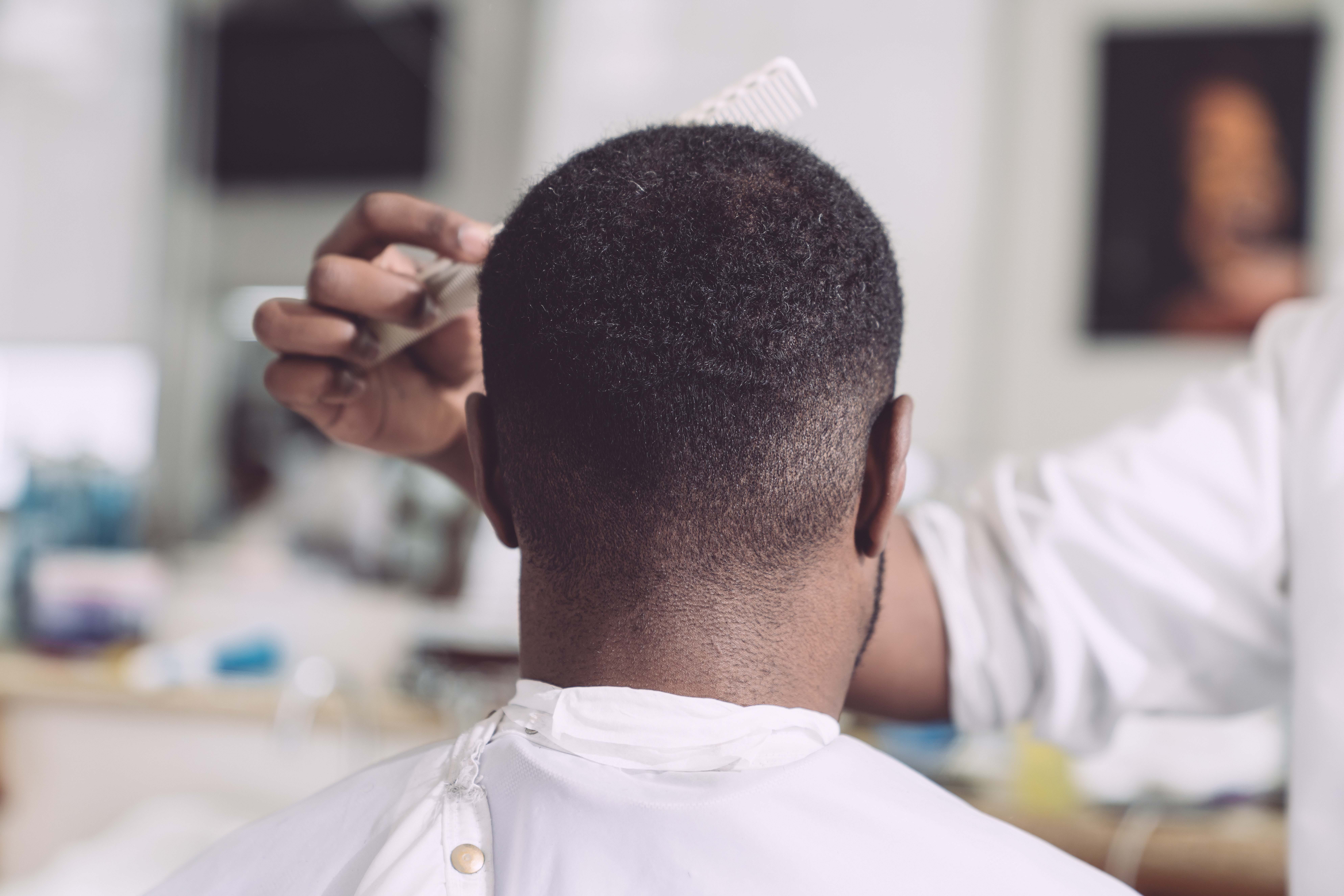 Managing Dandruff In Men Mono Medium