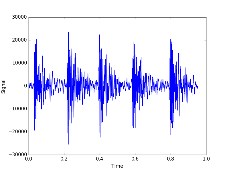 Sound Pattern Recognition With Python Adilson Neto Medium