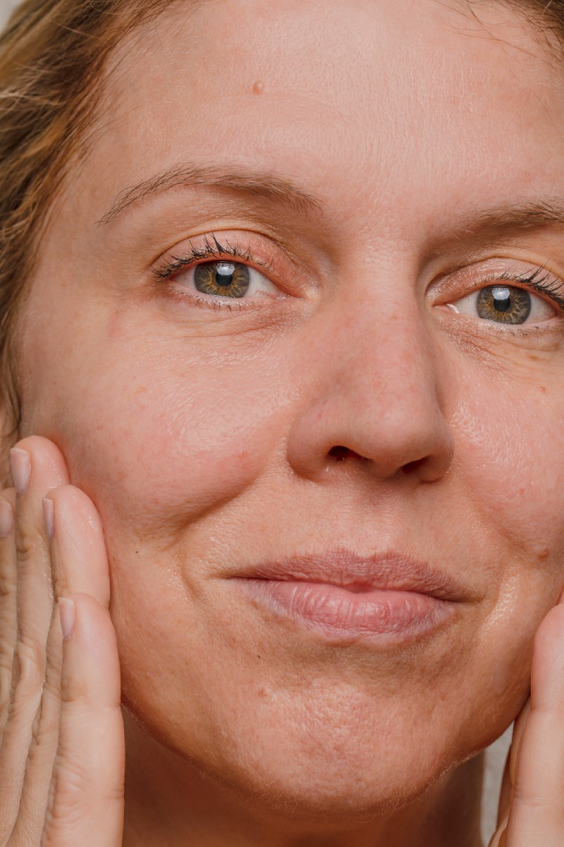 curology dark circles