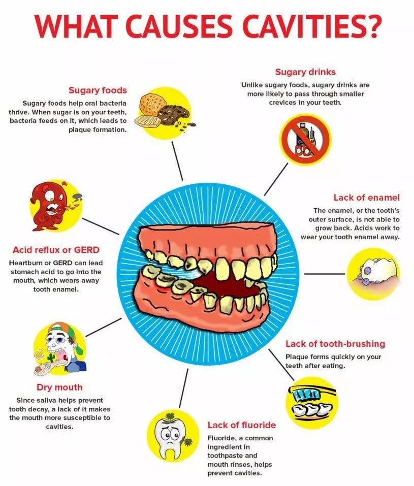 Tooth Decay Causes And Prevention Theron Coker Medium