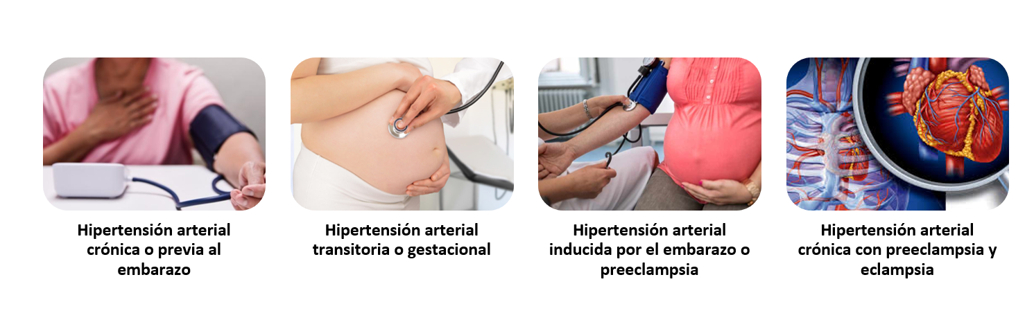 PREECLAMPSIA Y ECLAMPSIA. Hipertensión en el embarazo by